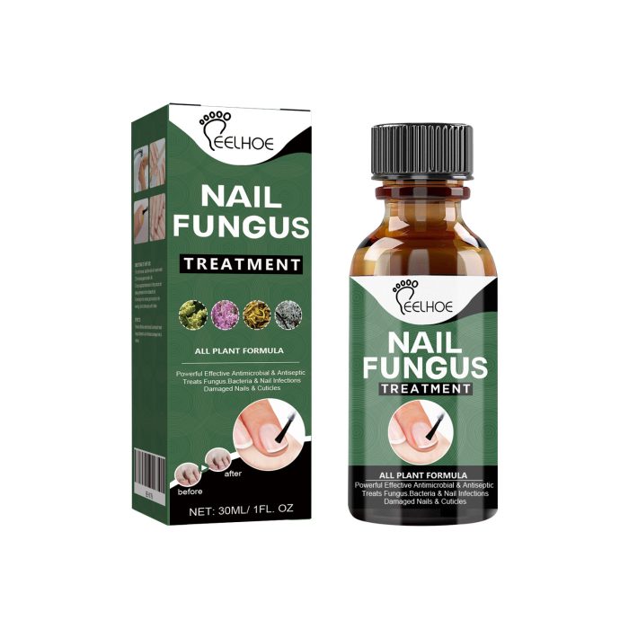 Foot Care Solution Onychomycosis Nail Care Solution - Image 4