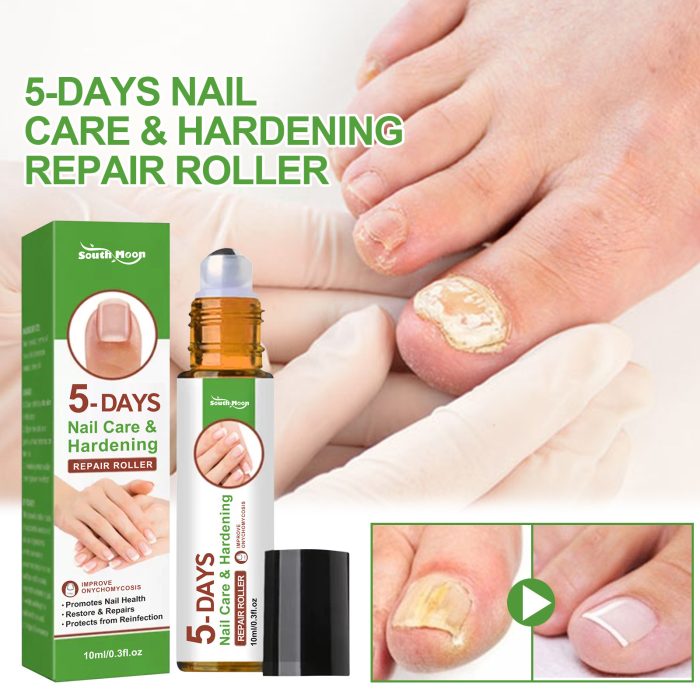 Best Nail Repair Roller Gray Thickening Nail Care Solution - Image 6