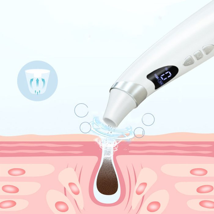 Best Electric Visual Blackhead Suction Instrument Household Cleansing Pore Cleaner For Skin - Image 2