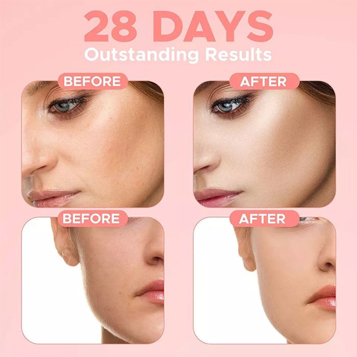 New Advence Skin Care 4 In 1 FACIAL SERUM - Image 5