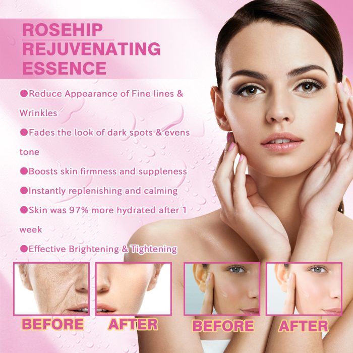 New Rose Fruit Skin Rejuvenation Moisturizing Toner - Image 3