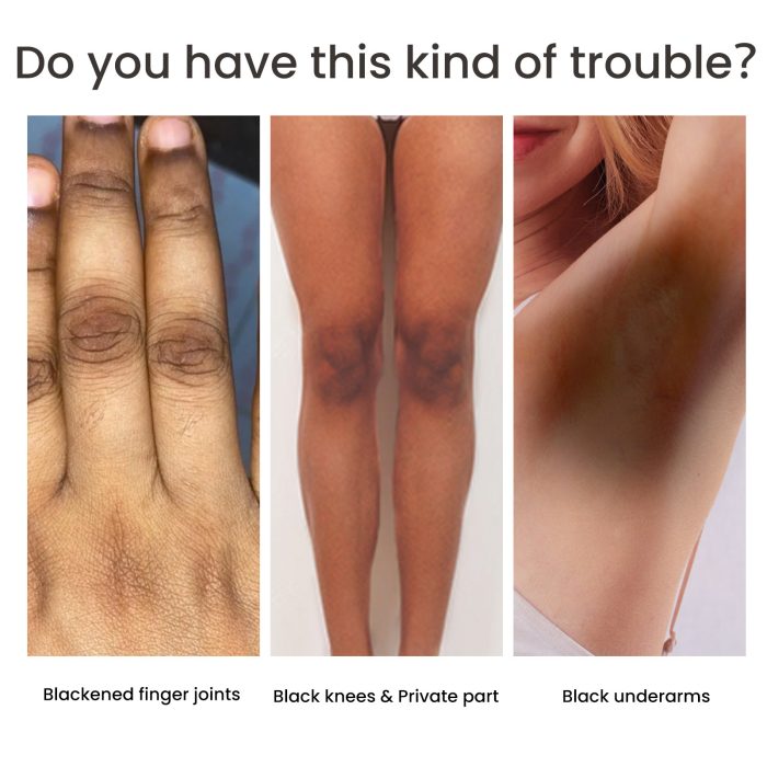 Women's Best Skin Pigmentation Care - Image 6