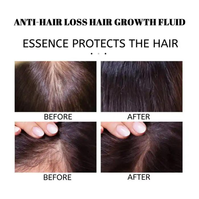 New Hair Care Essential Oil Disposable Hair Care Solution - Image 4