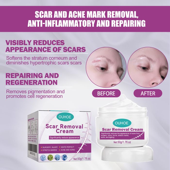 New Fade Scars Skin Care Moisturizing Smooth Skin Facial Neck Cream