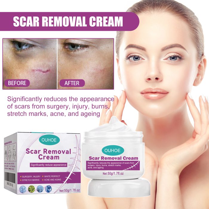 New Fade Scars Skin Care Moisturizing Smooth Skin Facial Neck Cream - Image 4