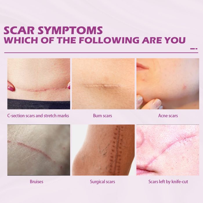 New Fade Scars Skin Care Moisturizing Smooth Skin Facial Neck Cream - Image 5