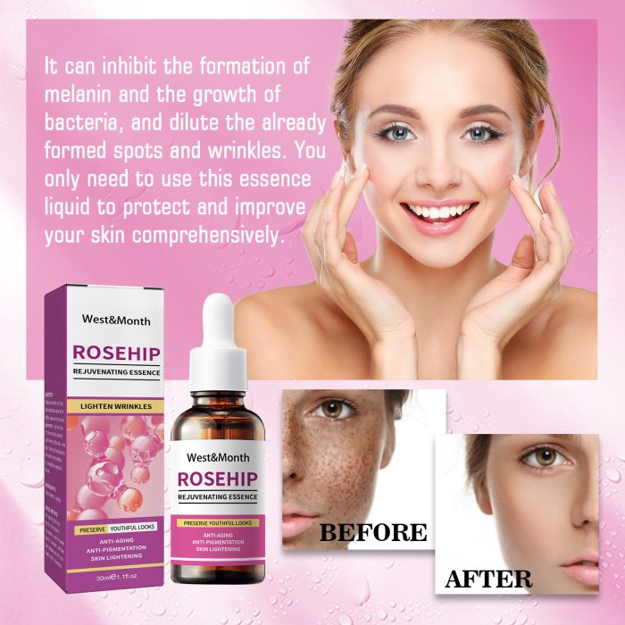 New Rose Fruit Skin Rejuvenation Moisturizing Toner - Image 5