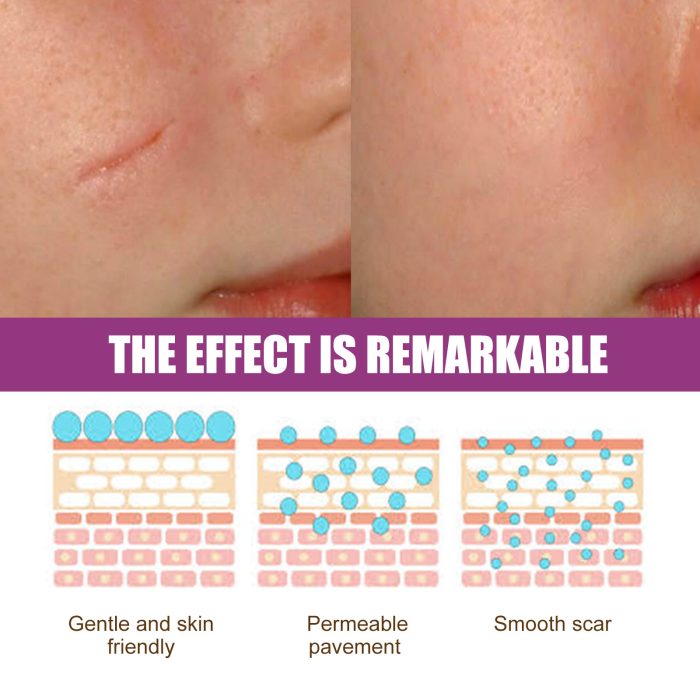 New Fade Scars Skin Care Moisturizing Smooth Skin Facial Neck Cream - Image 2