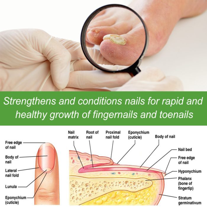Best Nail Repair Roller Gray Thickening Nail Care Solution - Image 4
