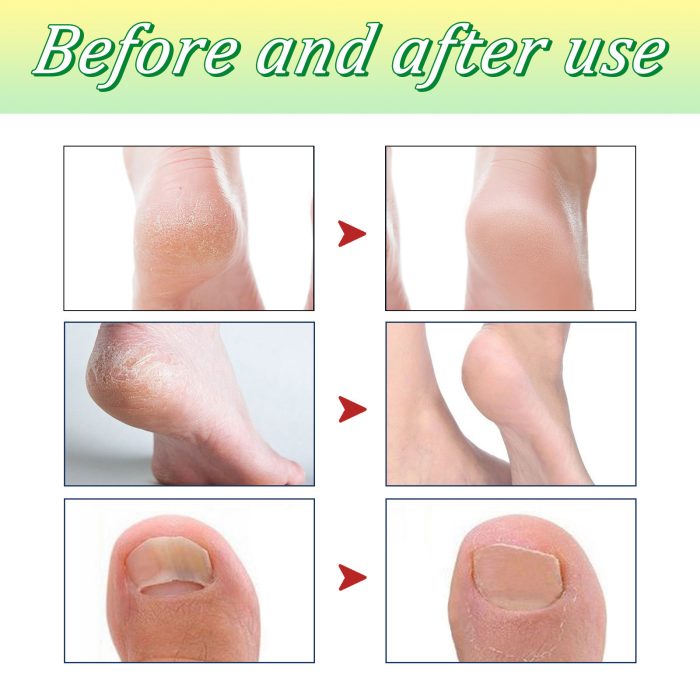 Best Cleaning Care Care Sleep Body Foot Bath Tablets - Image 5