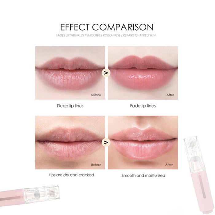 Lip Care Roller Portable Manual Lip Care Instrument - Image 2