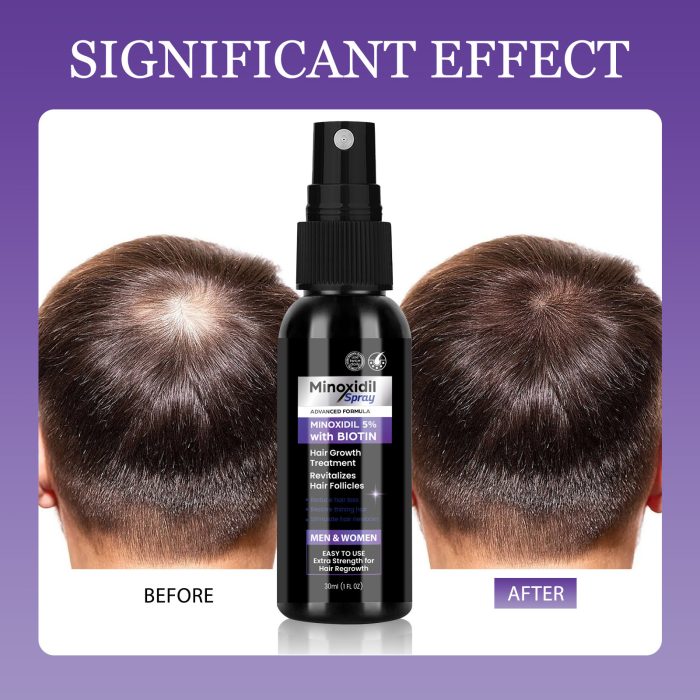 Best Mino Hair Care Nourishing Hair Supple Scalp Care - Image 3