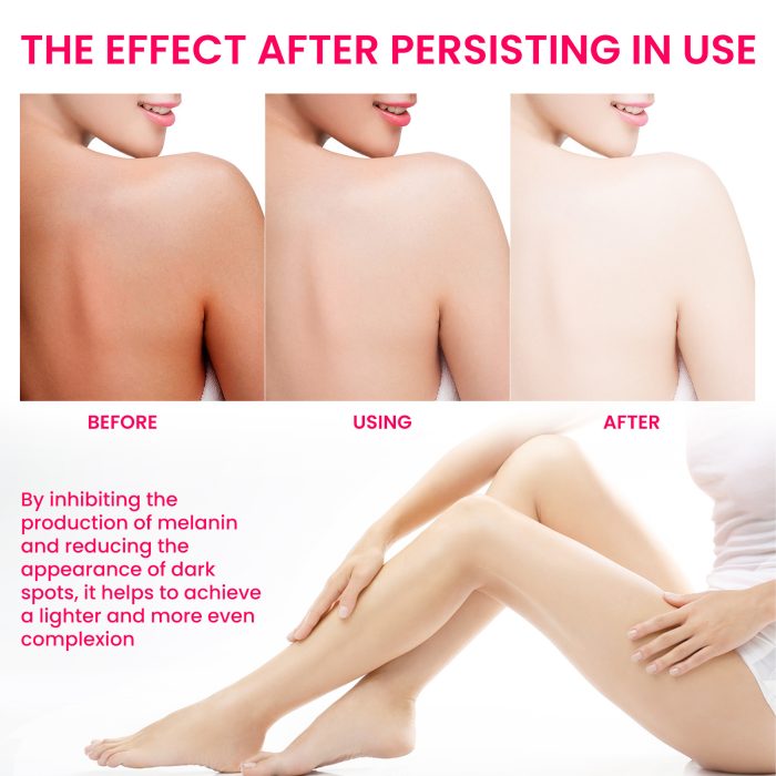 Women's Best Skin Pigmentation Care - Image 5